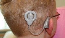 Los implantes cocleares en edad temprana mejoran la comprensión lectora de los niños