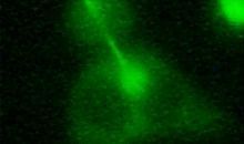 Una triple barrera protege las células de convertirse en cancerosas