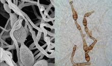 Descubren un principio activo para combatir las infecciones por hongos