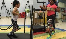 Una prótesis permite andar a niños con marcha agachada por parálisis cerebral